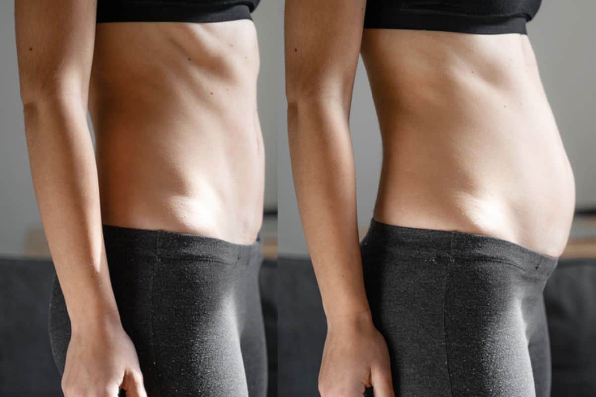 How long does diastasis recti take to improve Chesham?