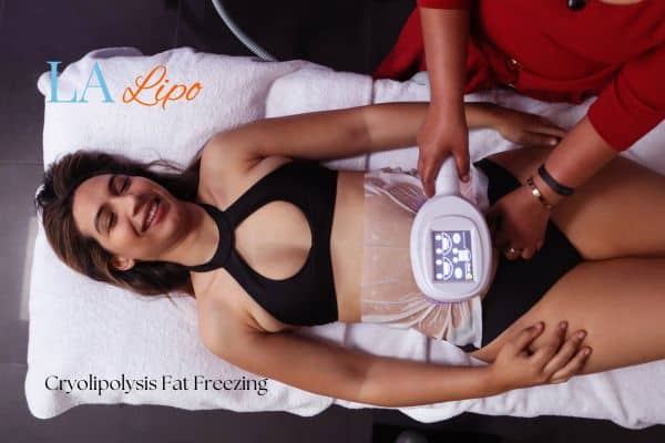woman getting cryolipolysis Chesham
