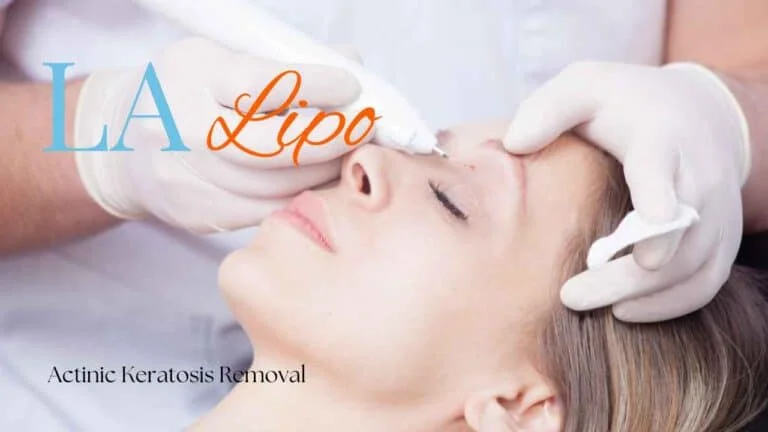 Woman receiving Actinic Keratosis Removal Treatment Chesham