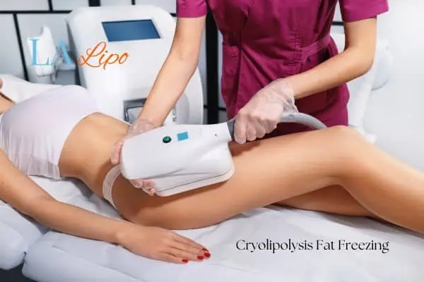 Woman receiving coolsculpting Chesham treatment on her thighs