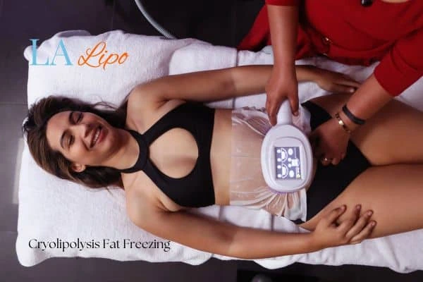 woman getting cryolipolysis Chesham