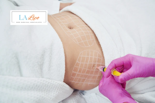 aqualyx fat dissolving injections Chesham