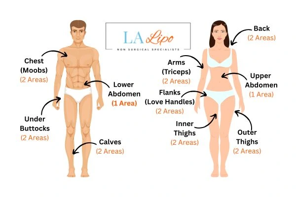 LA LIPO Cryolipolysis Areas Chesham