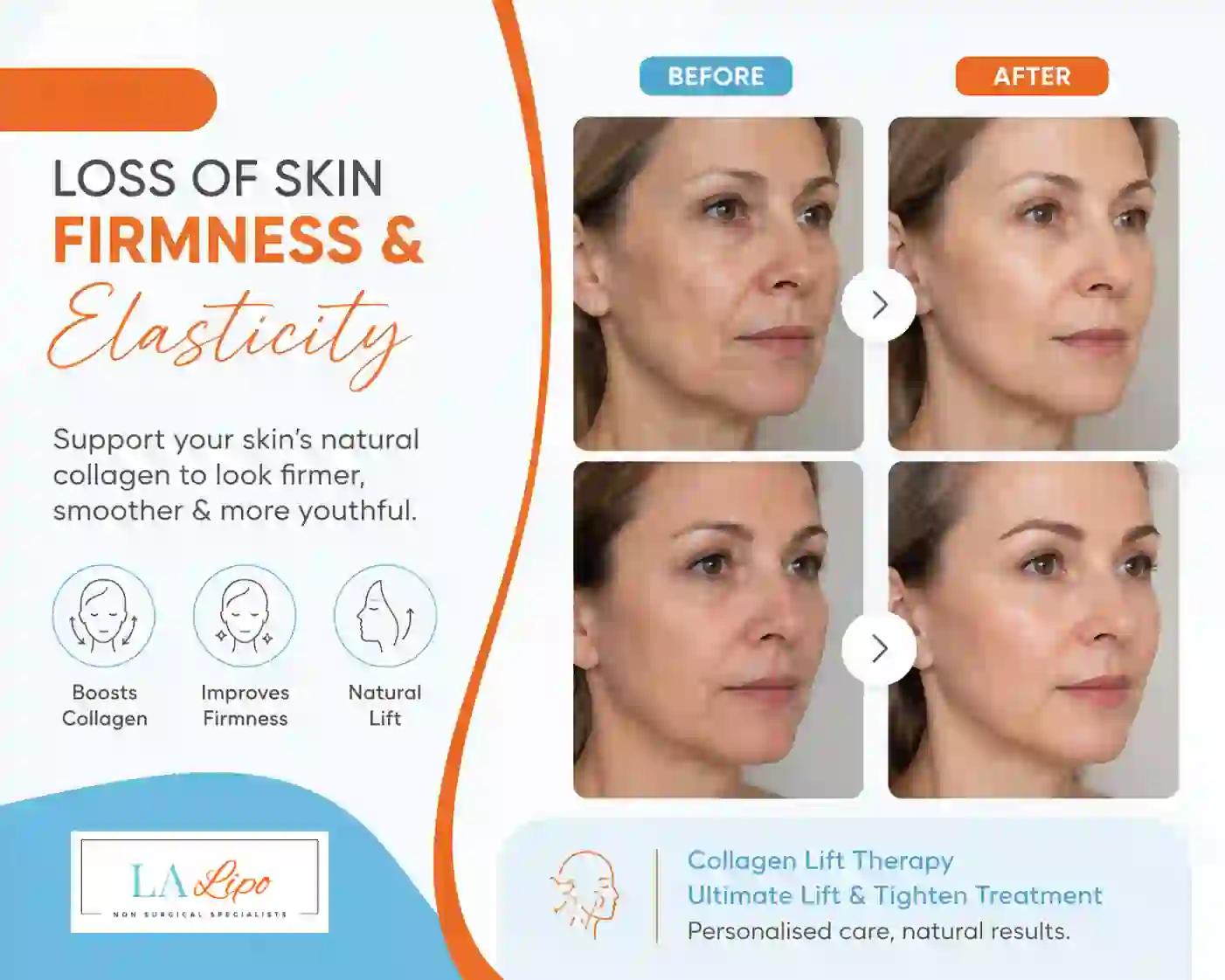Sign #7: Loss of Skin Firmness and Elasticity Chesham