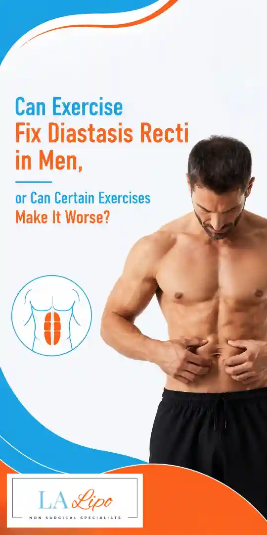Can Exercise Fix Diastasis Recti in Men, or Can Certain Exercises Make It Worse Chesham?