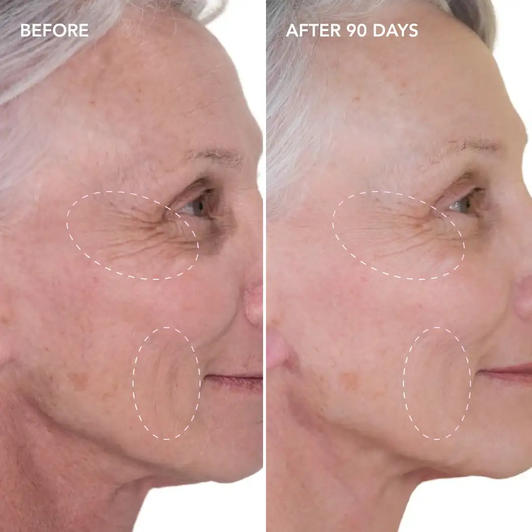 When will you see results Chesham